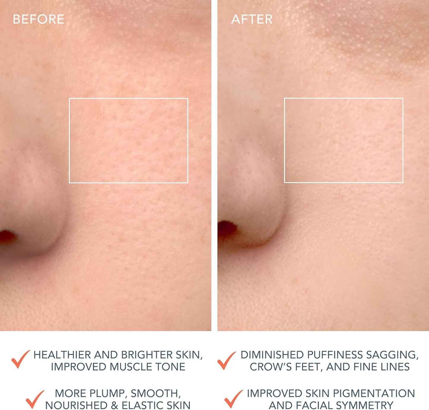 LUNA 4 Brosse Nettoyante Visage - Masseur Visage Raffermissant - Brosse Anti-Âge Visage - Améliore L'Absorption Des Produits De Soins De La Peau - Soin Du Visage Simple - Peau Équilibrée