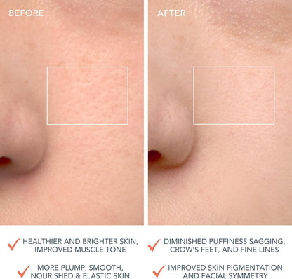 LUNA 4 Brosse Nettoyante Visage - Masseur Visage Raffermissant - Brosse Anti-Âge Visage - Améliore L'Absorption Des Produits De Soins De La Peau - Soin Du Visage Simple - Peau Équilibrée